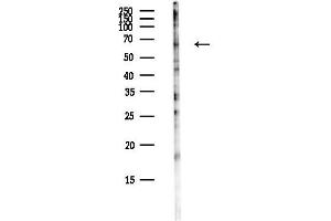 anti-Phospholipase B Domain Containing 2 (PLBD2) antibody