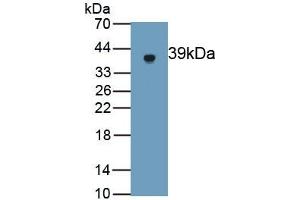 Detection of Recombinant GSDMD, Rat using Polyclonal Antibody to Gasdermin D (GSDMD) (GSDMD 抗体  (AA 1-326))