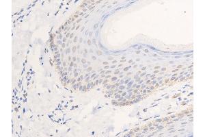 ABIN6267268 at 1/100 staining human skin tissue sections by IHC-P. (EGFR 抗体  (pSer1026))