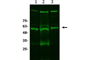Western Blotting (WB) image for anti-Solute Carrier Family 7, (Cationic Amino Acid Transporter, Y+ System) Member 11 (SLC7A11) antibody (ABIN6655337)