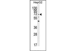 Western blot analysis of LRRC33 Antibody (C-term) in HepG2 cell line lysates (35ug/lane). (LRRC33 抗体  (C-Term))