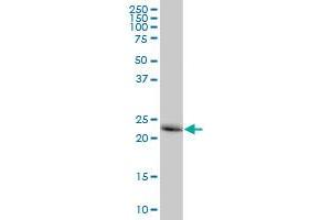 CTSB MaxPab polyclonal antibody. (Cathepsin B 抗体  (AA 1-339))