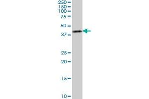 ASCL1 monoclonal antibody (M03), clone 3D3 Western Blot analysis of ASCL1 expression in C32 .