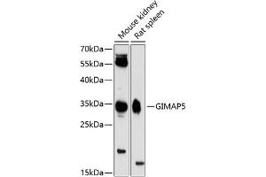 Western blot analysis of extracts of various cell lines, using GIM antibody (ABIN6127954, ABIN6141085, ABIN6141086 and ABIN6224753) at 1:3000 dilution. (GIMAP5 抗体  (AA 190-270))