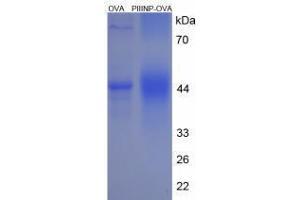 Image no. 3 for Procollagen III N-Terminal Propeptide (PIIINP) (N-Term) peptide (Ovalbumin) (ABIN5666354)