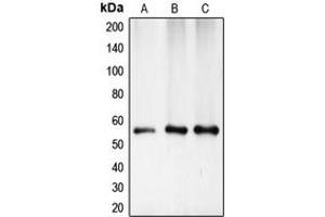 Western blot analysis of CHK1 expression in HeLa (A), mouse kidney (B), rat heart (C) whole cell lysates. (CHEK1 抗体  (Center))