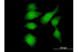 Immunofluorescence of monoclonal antibody to FGFR1OP on HeLa cell. (FGFR1OP 抗体  (AA 1-379))