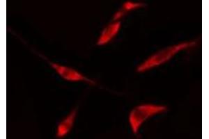 ABIN6275728 staining  LOVO cells by IF/ICC. (THO Complex 4 抗体  (Internal Region))