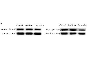 Western Blotting (WB) image for anti-Actin, beta (ACTB) antibody (ABIN3020544)