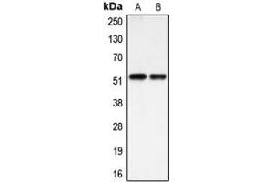 Western blot analysis of BMP3A expression in HEK293T (A), HuvEc (B) whole cell lysates. (BMP3 抗体  (Center))