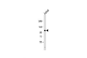 Western Blot at 1:1000 dilution + Jurkat whole cell lysate Lysates/proteins at 20 ug per lane. (PARG 抗体  (C-Term))