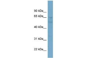WB Suggested Anti-ZNF671 Antibody Titration:  0. (ZNF671 抗体  (N-Term))
