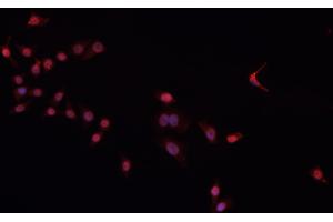 ABIN6266604 staining Daudi cells by IF/ICC. (Oct-2 抗体)