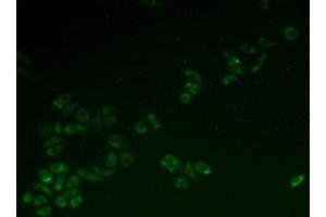 Detection of HCCS in Hela cells using Polyclonal Antibody to Holocytochrome C Synthase (HCCS) (HCCS 抗体  (AA 1-268))