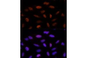 Immunofluorescence analysis of U-2 OS cells using ADNP Polyclonal Antibody (ABIN1678582, ABIN3019032, ABIN3019033 and ABIN6220678) at dilution of 1:100 (40x lens). (ADNP 抗体  (AA 843-1102))