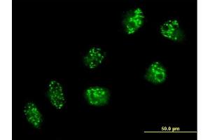 Immunofluorescence of purified MaxPab antibody to USP16 on HeLa cell. (USP16 抗体  (AA 1-822))