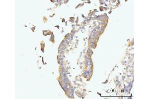 IHC analysis of Golgin 97/GOLGA1 using anti-Golgin 97/GOLGA1 antibody (ABIN7599539).