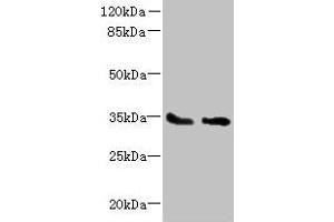 Western blot All lanes: SLC25A36 antibody at 4 μg/mL Lane 1: A431 whole cell lysate Lane 2: A549 whole cell lysate Secondary Goat polyclonal to rabbit IgG at 1/10000 dilution Predicted band size: 35, 15, 18 kDa Observed band size: 35 kDa (SLC25A36 抗体  (AA 58-110))