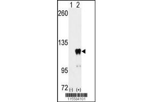 Western blot analysis of PUM2 using PUM2 Antibody (S182) using 293 cell lysates (2 ug/lane) either nontransfected (Lane 1) or transiently transfected with the PUM2 gene (Lane 2). (PUM2 抗体  (AA 159-189))