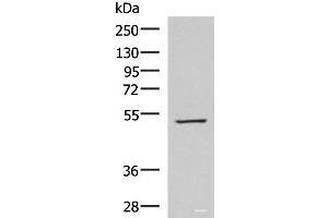 Western blot analysis of HepG2 cell lysate using FDXR Polyclonal Antibody at dilution of 1:1000 (Ferredoxin Reductase 抗体)