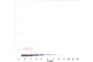 Image no. 2 for anti-Chemokine (C-X-C Motif) Ligand 14 (CXCL14) antibody (ABIN465239) (CXCL14 抗体)