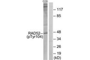 Western blot analysis of extracts from COS7 cells treated with H2O2 100uM 30', using RAD52 (Phospho-Tyr104) Antibody. (RAD52 抗体  (pTyr104))