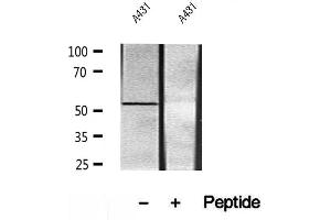 Western blot analysis of extracts of A431 cells, using UBAP1 antibody. (UBAP1 抗体)