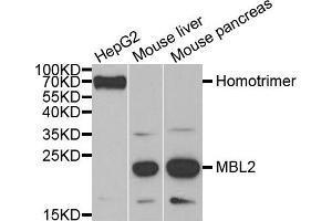 Western blot analysis of extracts of various cell lines, using MBL2 antibody. (MBL2 抗体)