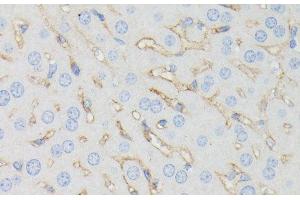 Immunohistochemistry of paraffin-embedded Mouse liver using IFITM1 Polyclonal Antibody at dilution of 1:100 (40x lens). (IFITM1 抗体)