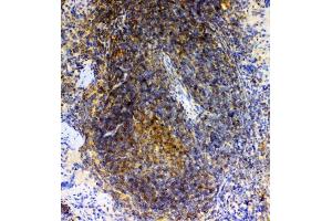 IHC analysis of GRK2 using anti-GRK2 antibody (ABIN5693069). (GRK2 抗体)