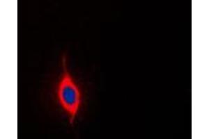 Immunofluorescent analysis of SURF1 staining in Jurkat cells. (SURF1 抗体  (Center))