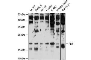 Western blot analysis of extracts of various cell lines, using PDF antibody (ABIN6127992, ABIN6145370, ABIN6145371 and ABIN6214719) at 1:1000 dilution. (GDF15 抗体  (AA 40-243))