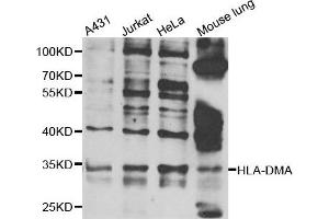 Western blot analysis of extracts of various cell lines, using HLA-DMA antibody. (HLA-DMA 抗体)
