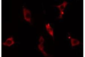ABIN6275093 staining  Hela cells by IF/ICC. (RNF125 抗体  (Internal Region))