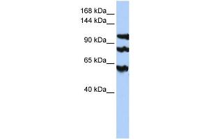 WB Suggested Anti-PPP1R13B  Antibody Titration: 0. (PPP1R13B 抗体  (Middle Region))