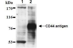 Western Blotting (WB) image for anti-CD44 (CD44) antibody (ABIN1449180) (CD44 抗体)