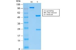 SDS-PAGE Analysis Purified PTH Monospecific Recombinant Rabbit Monoclonal Antibody (PTH/2295R). (Recombinant PTH 抗体  (AA 32-115))