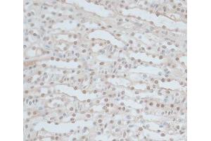 Immunohistochemistry of paraffin-embedded Mouse kidney using ZNF562 Polyclonal Antibody at dilution of 1:100 (40x lens). (ZNF562 抗体)
