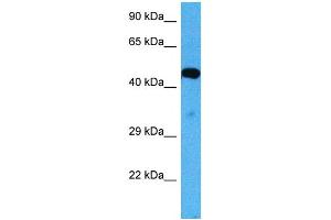 Host:  Mouse  Target Name:  ACVR2B  Sample Tissue:  Mouse Skeletal Muscle  Antibody Dilution:  1ug/ml (ACVR2B 抗体  (Middle Region))