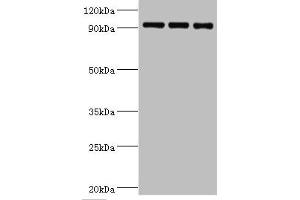 Western blot All lanes: Heat shock protein 105 kDa antibody at 1 μg/mL Lane 1: MCF-7 whole cell lysate Lane 2: Hela whole cell lysate Lane 3: Mouse brain tissue Secondary Goat polyclonal to rabbit IgG at 1/10000 dilution Predicted band size: 97, 93, 98 kDa Observed band size: 97 kDa (HSPH1 抗体  (AA 659-858))