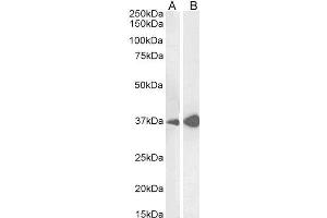 ABIN190828 (0. (Liver Arginase 抗体  (C-Term))