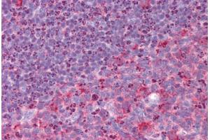 Human Tonsil: Formalin-Fixed, Paraffin-Embedded (FFPE) (RHBDD3 抗体  (Internal Region))