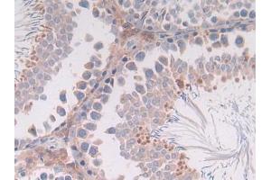 Detection of IL4 in Rat Testis Tissue using Monoclonal Antibody to Interleukin 4 (IL4) (IL-4 抗体  (AA 61-111))