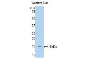 Western Blotting (WB) image for anti-Mannan-Binding Lectin serine Peptidase 2 (MASP2) (AA 170-287) antibody (ABIN1173814) (MASP2 抗体  (AA 170-287))