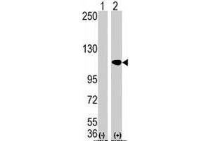 Western blot analysis of AOF2 (arrow) using AOF2 polyclonal antibody . (LSD1 抗体  (N-Term))