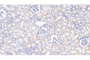 anti-Insulin-Like Growth Factor Binding Protein 2, 36kDa (IGFBP2) (AA 34-317) antibody