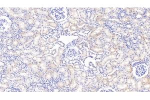 Detection of IGFBP2 in Bovine Kidney Tissue using Polyclonal Antibody to Insulin Like Growth Factor Binding Protein 2 (IGFBP2) (IGFBP2 抗体  (AA 34-317))