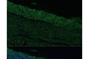 Immunofluorescence (IF) image for anti-Interleukin 25 (IL25) antibody (ABIN7264293)