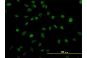 Image no. 4 for anti-Zinc Finger Protein 207 (ZNF207) (AA 1-111) antibody (ABIN599016) (ZNF207 抗体  (AA 1-111))