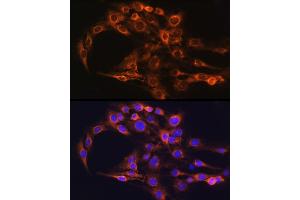 Immunofluorescence analysis of C6 cells using FCGRT Rabbit pAb (ABIN6127922, ABIN6140552, ABIN6140553 and ABIN6224639) at dilution of 1:100 (40x lens). (FcRn 抗体  (AA 25-300))